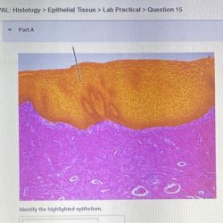 Tissue pal histology muscle lab practical question muscular highlighted exercise solved transcribed text show identify