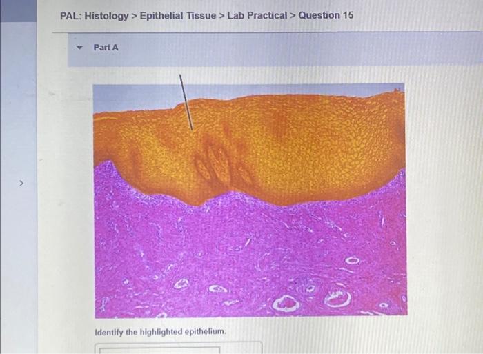 Tissue pal histology muscle lab practical question muscular highlighted exercise solved transcribed text show identify